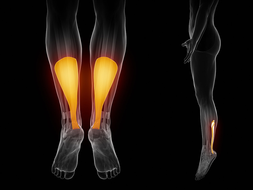 Gründe für Rupturen an der Achillessehne MedMix
