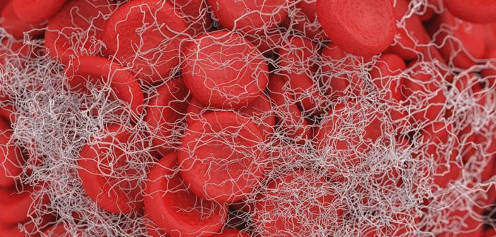 Caplacizumab für Erwachsene mit aTTP MedMix