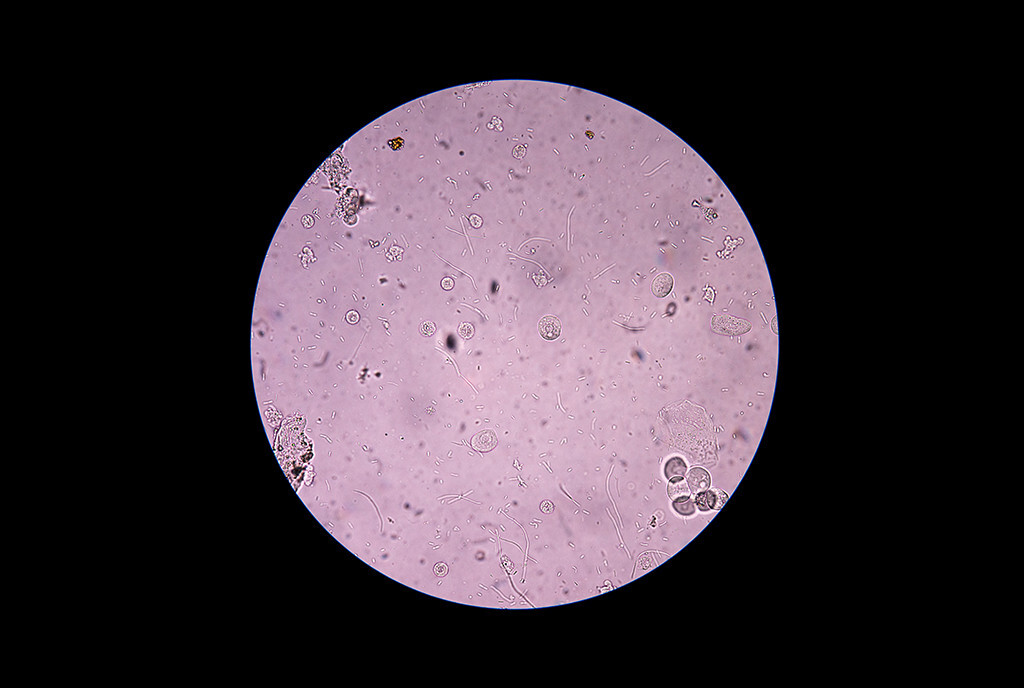 Coli Bakterien Im Urin Captions More