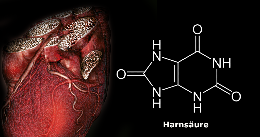 Harnsäure Zu Hoch Im Blut pregnancyinfoca.blogspot.com