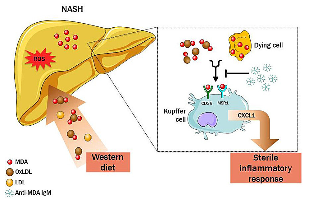 Malondialdehyd Biomarker für oxidativen Stress MedMix