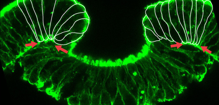 Embryonalentwicklung MedMix