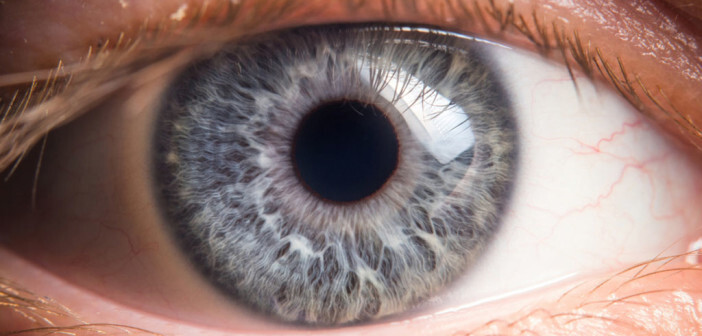 Iridologie, Irisdiagnostik – Lehre von der Iris - MedMix